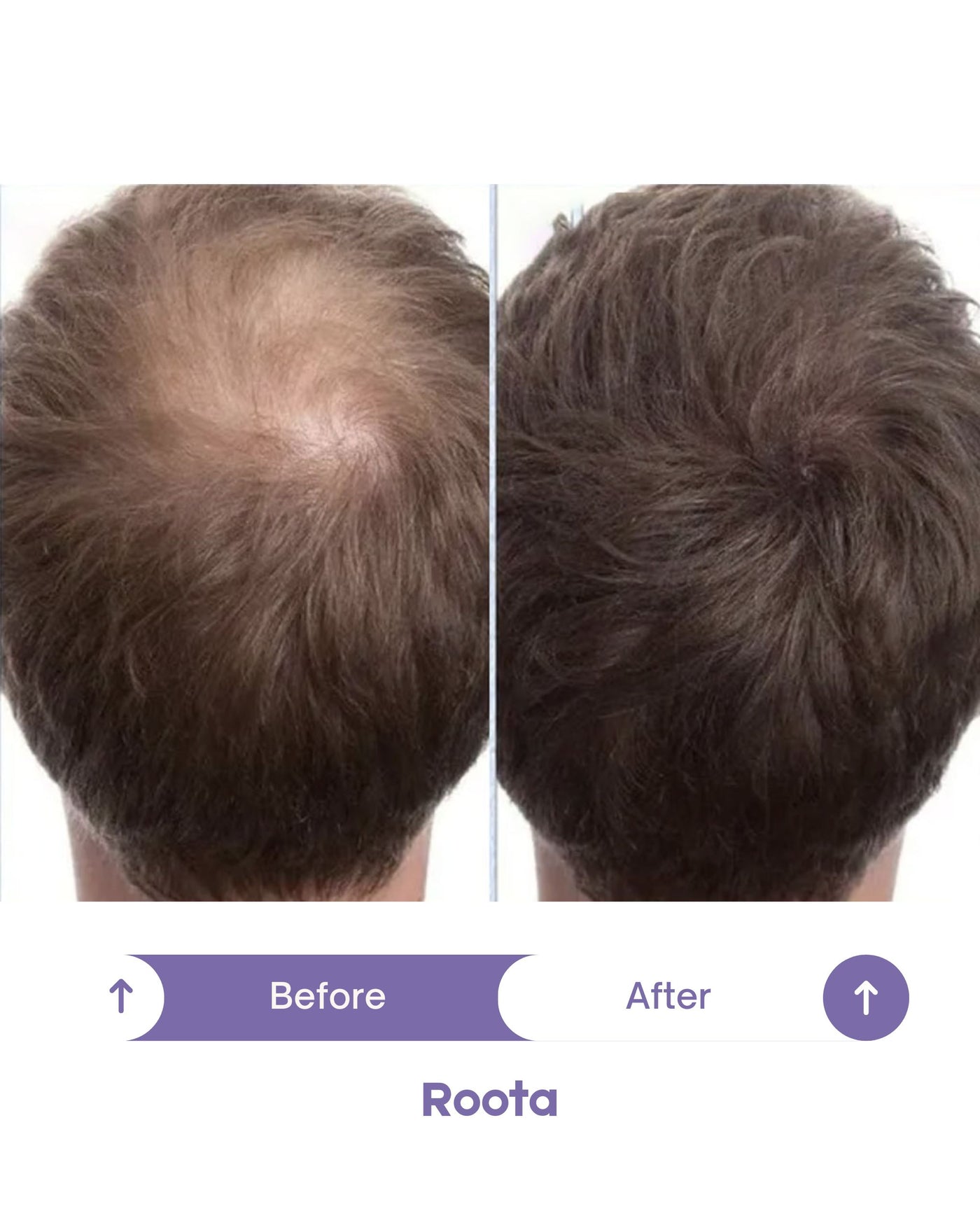 Roota Peptide Hair Spray