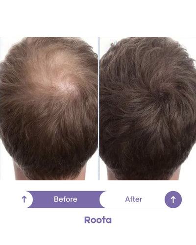 Roota Peptide Hair Spray