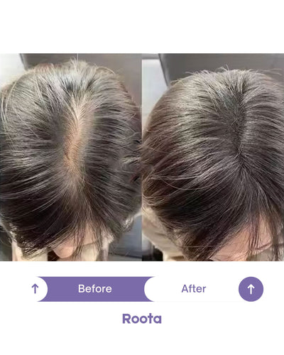 Roota Peptide Hair Growth Oil