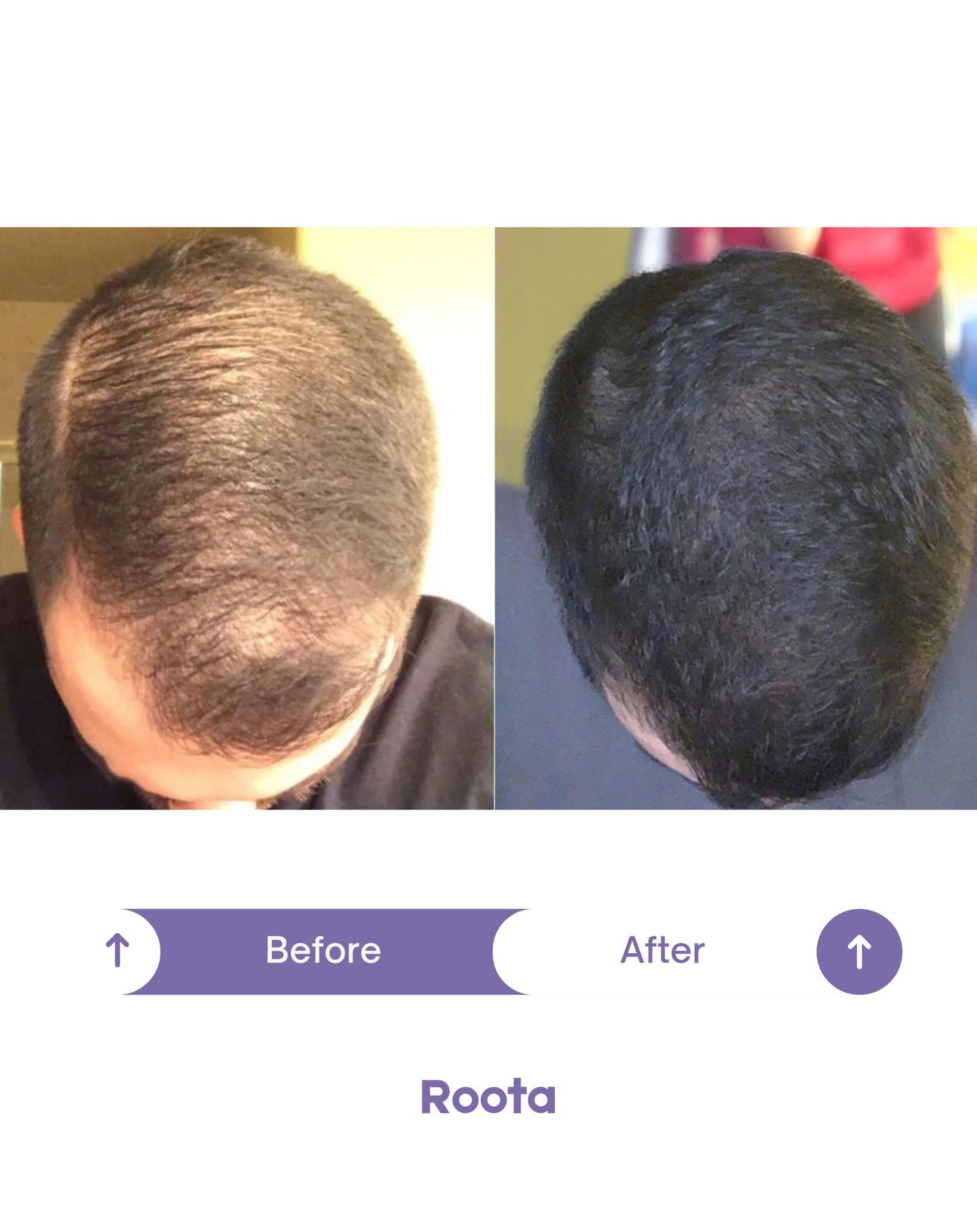 Roota Peptide Hair Growth Oil
