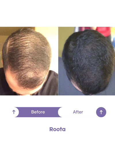Roota Peptide Hair Growth Oil